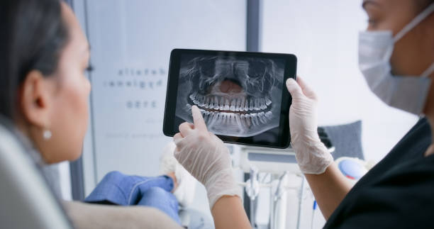 Licensed Tooth Extraction service in Los Altos, CA - Smile Center Dentistry